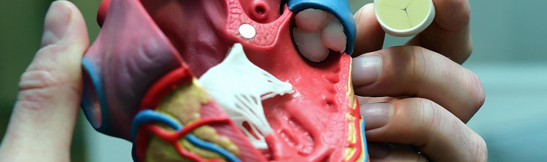 Xeltis: ‘levende’ hartkleppen van biologisch afbreekbare polymeren