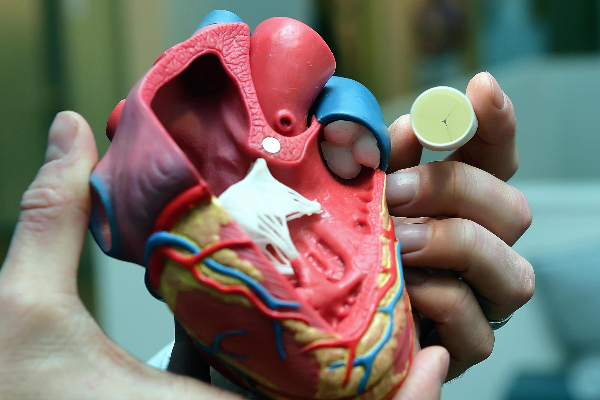 Xeltis: "living" heart valves made of biodegradable polymers
